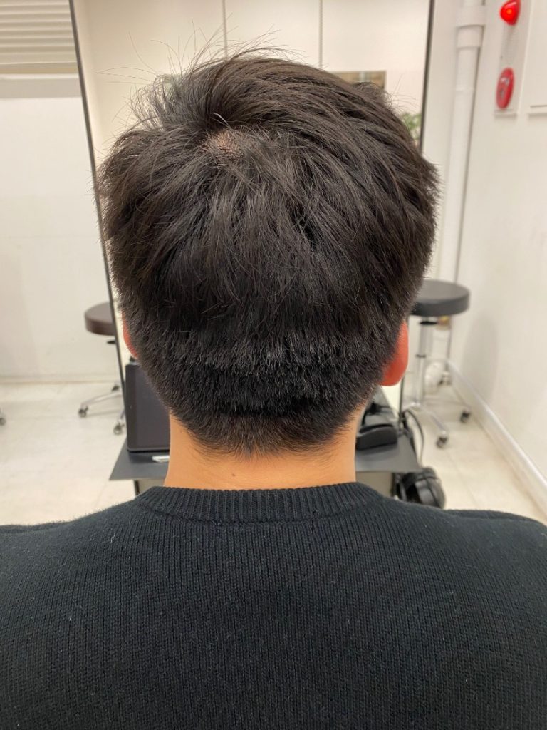 ハチ張りと直毛に悩む男性必見 限界まで刈り上げた個性派スタイル Ryohei Kato