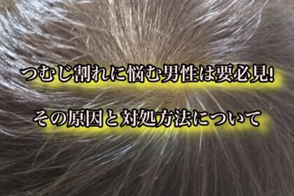 つむじ割れに悩む男性は要必見 その原因と対処方法について Ryohei Kato