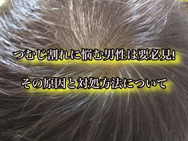 つむじ割れに悩む男性は要必見 その原因と対処方法について Ryohei Kato