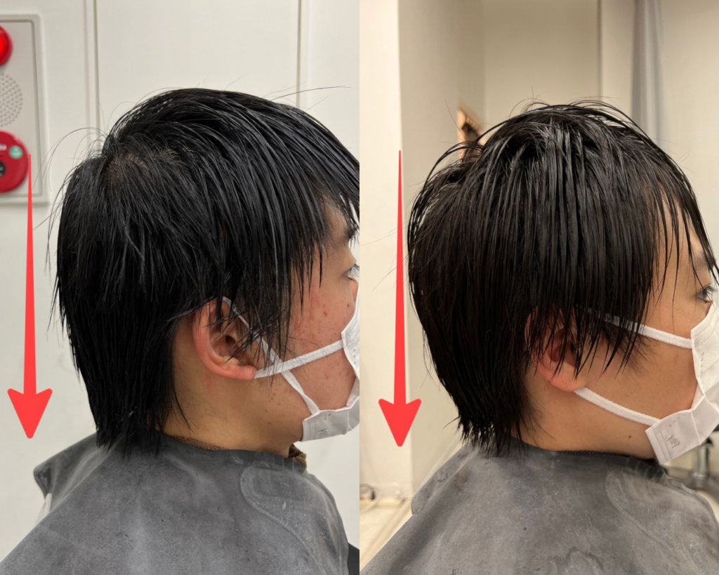 メンズの絶壁を解決する方法とは 頭の形を変える方法を徹底に解説 Ryohei Kato